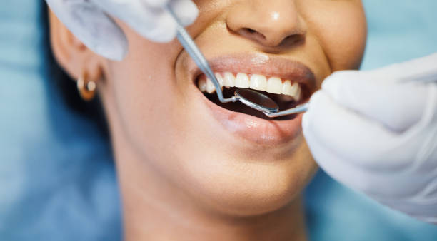Best Emergency Dental Care for Broken or Chipped Teeth in Mastic Beach, NY