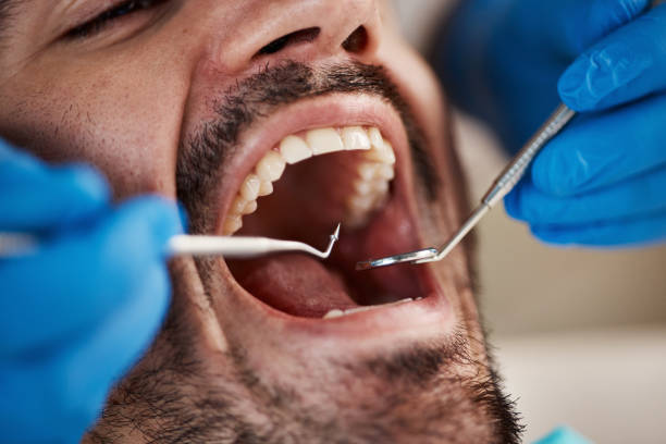 Best Emergency Dental Care for Broken or Chipped Teeth in Mastic Beach, NY